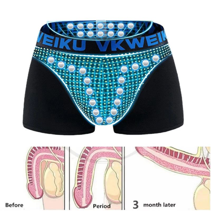 

Man Magnetic Therapy Energy Boxers England Body Ability Enhance Lingerie Tourmaline Fiber Briefs U-Convex Anti-bacterial Trunks