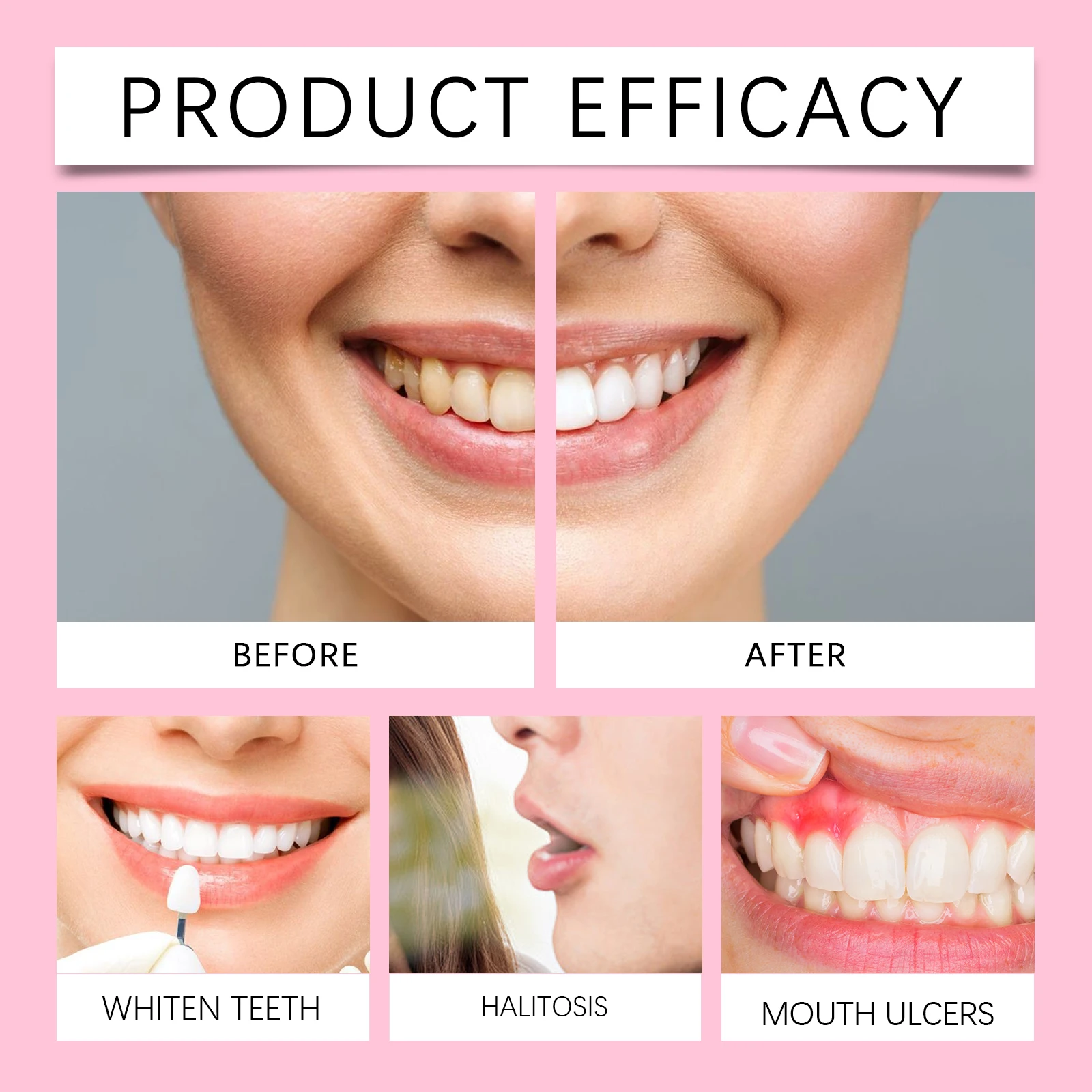 Zahnpasta zur Aufhellung von Fleckenentfernung, Entfernung von Flecken, Zahnstein, Mundgeruch, Aufhellung der Zähne, frischer Atem, stärkende Zahnschmelz