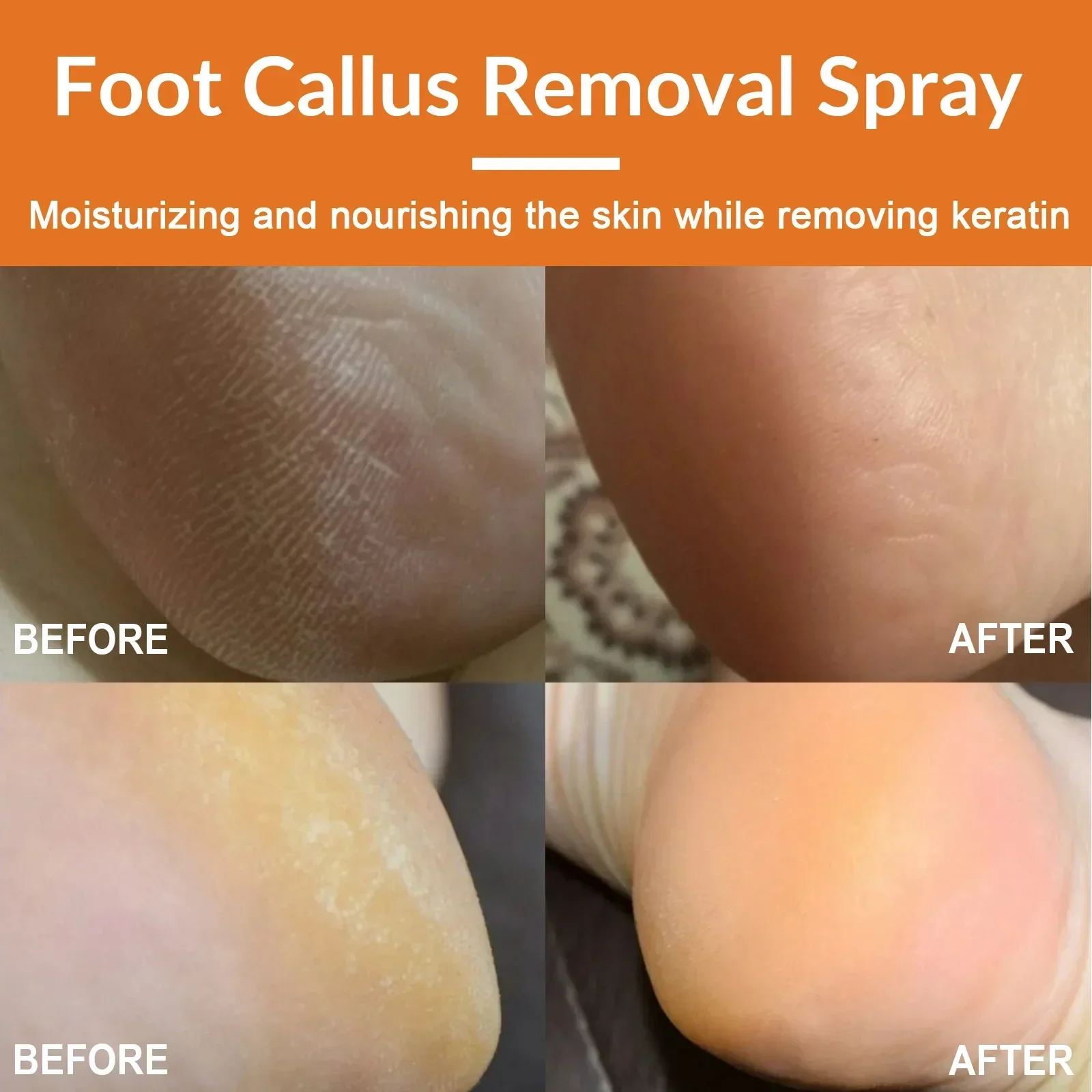 Foot Exfoliating Spray Gently Remove Dead Skin Clean and Repair Rough Skin Remove Calluses Foot Skin Care Pedicure Beauty Health