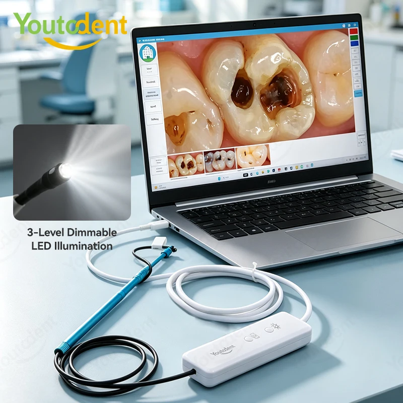 USB Dental Root Canal Endoscope 5MP Micro Intraoral Oral Camera HD mini Visual Tooth Camera for Windows System