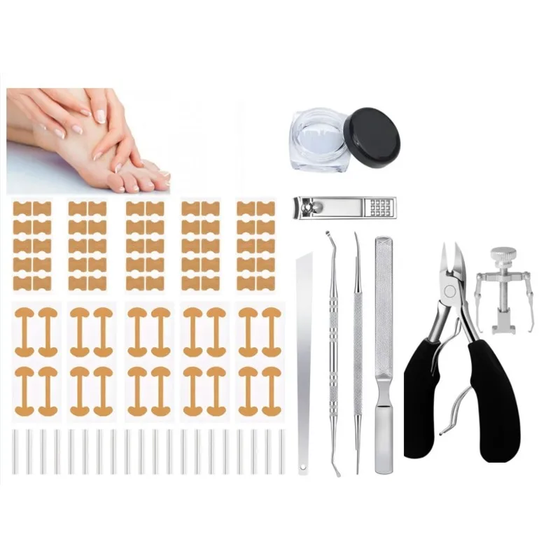 

【SURPRISE】лента для коррекции ногтей и набор корректоров для вросших ногтей (18 шт.), инструмент для домашнего педикюра и ногтей