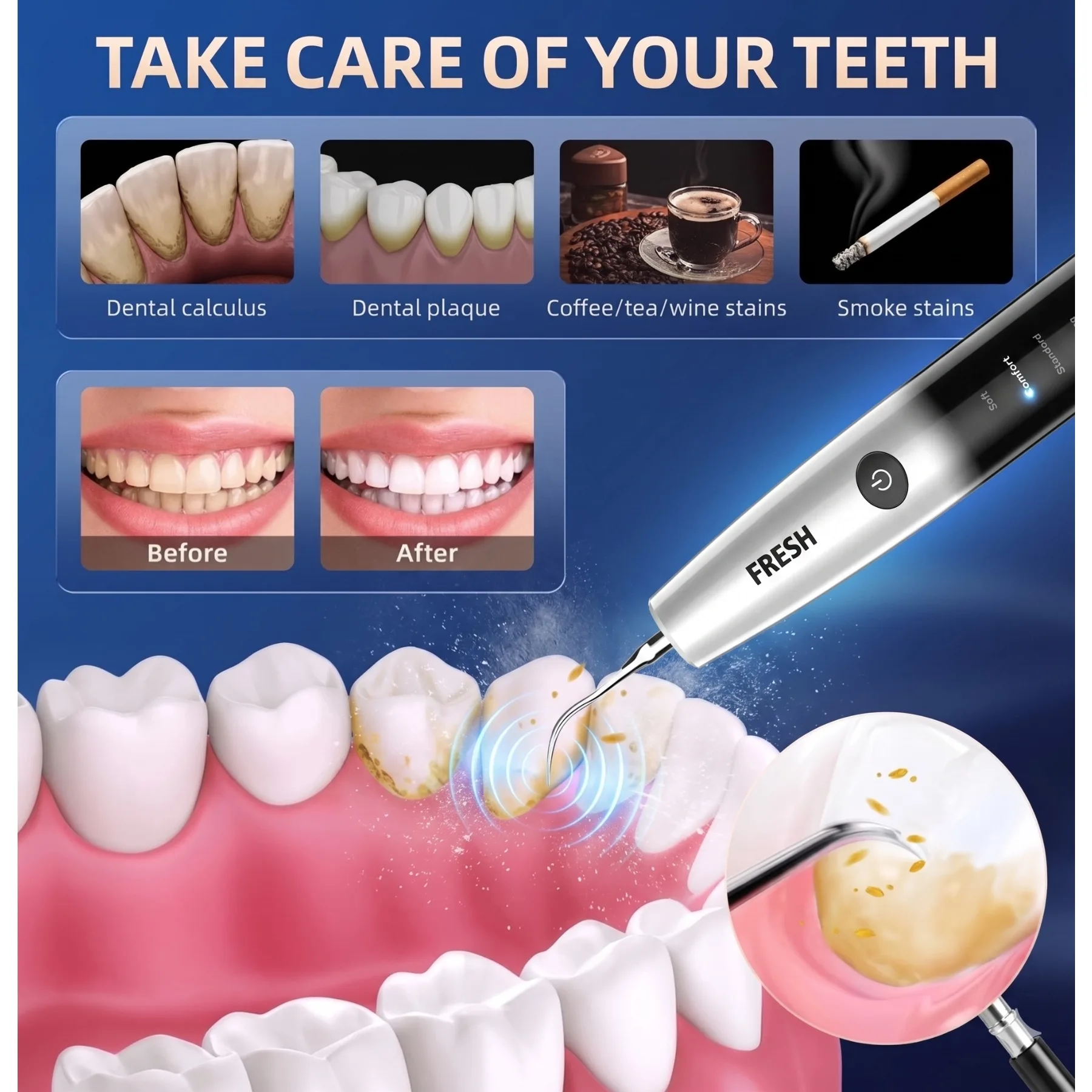 Thumbnail 4 - #38 Ultrasonic Scalers List of Top Picks