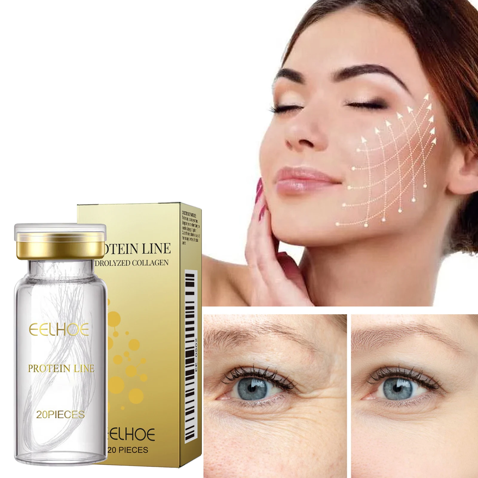 コラーゲン糸 フェイスリフト 肌の引き締め 若返り 小じわの改善 顔の栄養補給 深層修復 肌の引き締め プロテインライン