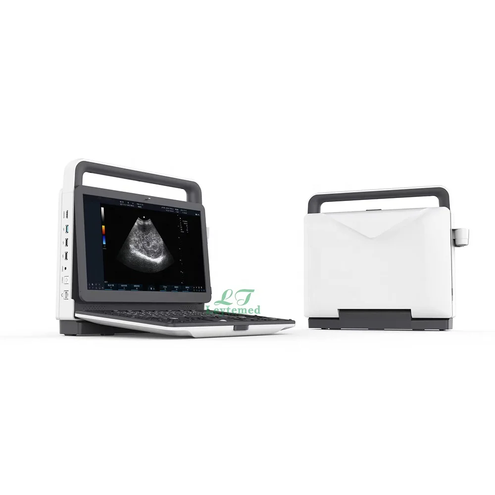 LTUB74 Medical Science 15.6-inch Portable Color Doppler Pregnancy Ultrasound Diagnostic System Machine