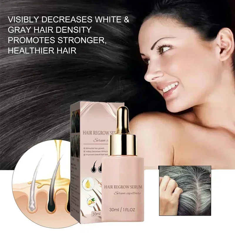 Suero para el crecimiento rápido del cabello, pérdida de cabello tratamiento Anti, adelgazamiento, previene la calvicie, cura del cuero cabelludo, nutre las raíces del cabello fuertes, aceite esencial