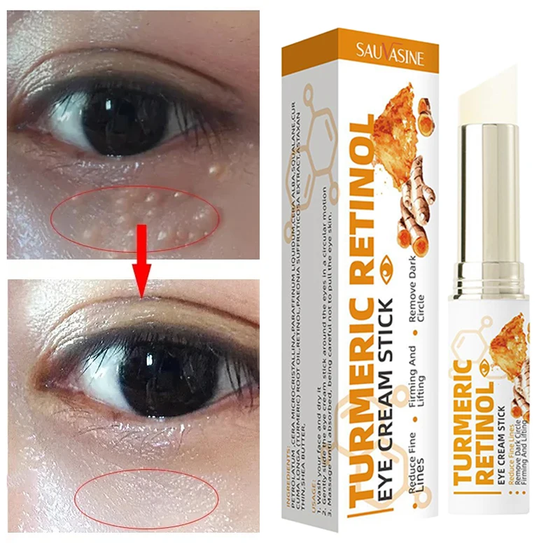 

Fading Fat Granules Eye Cream Reducing Swelling Firming Cream Reducing Fine Lines Repairing Skin Barrier Hydrating Moisturizing