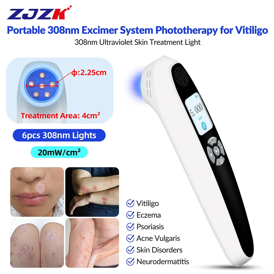 

2026 Home Use 308nm UVB Phototherapy Lamp 6 Diodes for Vitiligo Psoriasis Eczema 20mW/cm2 0-180s Timer 1800mAh Rechargeable