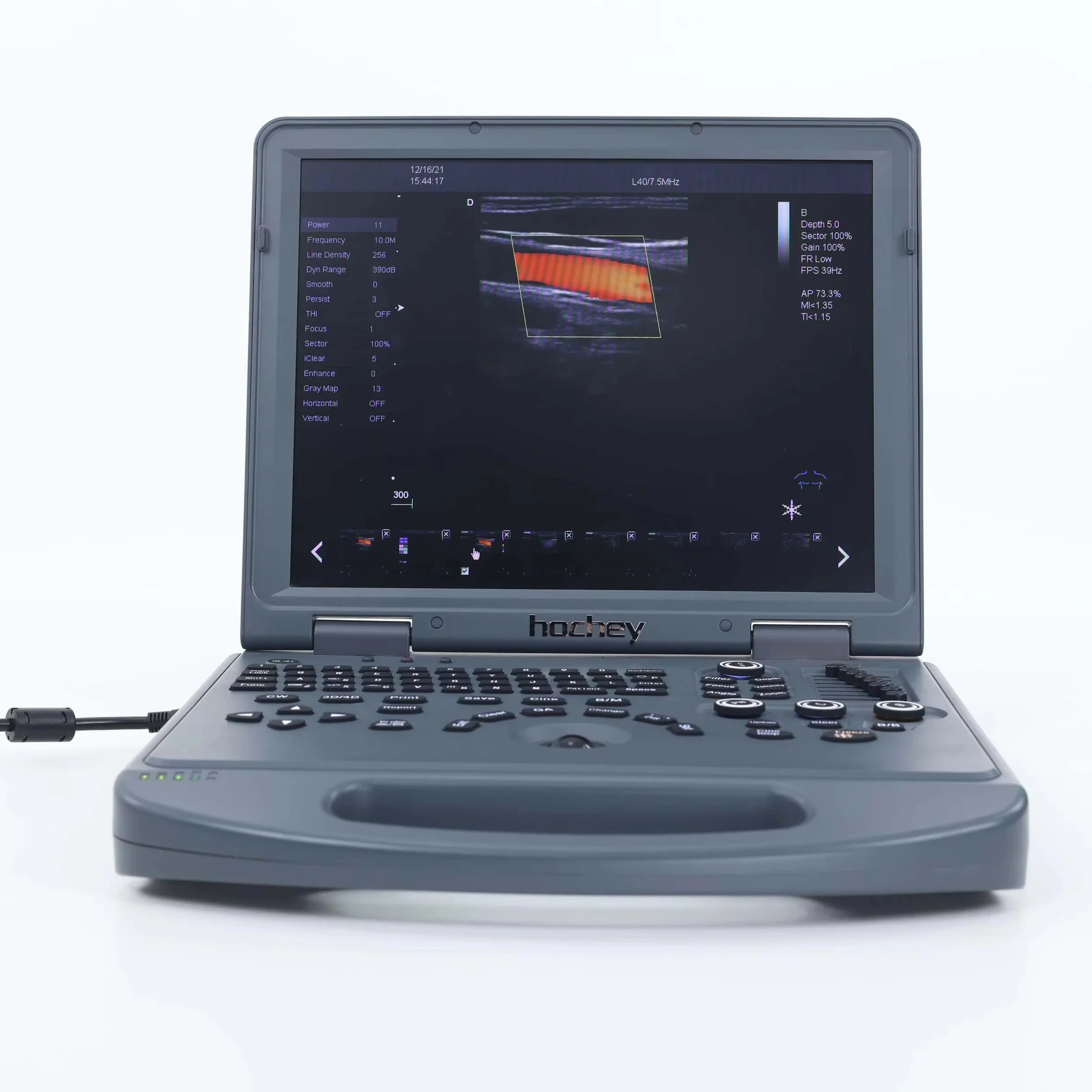 MT Medical Veterinary Medicine Portable Scanner Echo Ultrasound Ultrasonography Machine 4D Color Doppler