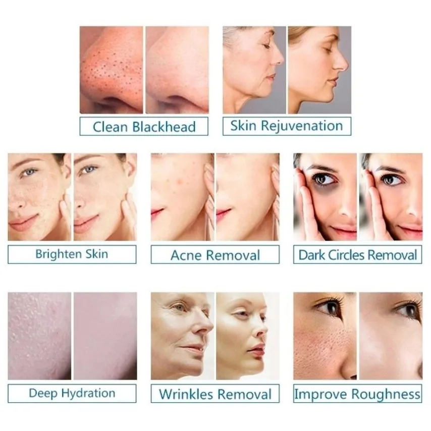 أحدث هيدرا 6 في 1 تنظيف الوجه صالون فراغ العناية الأساسية المياه النفاثة قشر هيدرو الهيدروجين الأكسجين جهاز تجميل الوجه #6