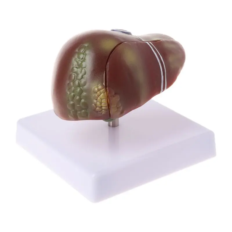 

Human Liver Pathological Anatomical Model Anatomy School Medical Teaching Displa Drop Shipping