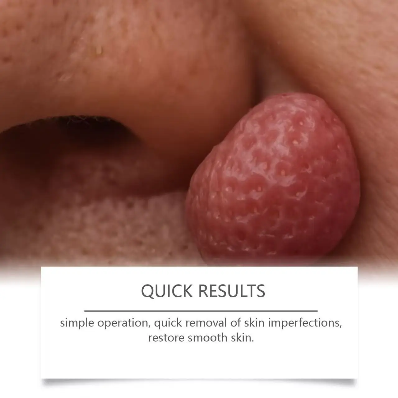 Blue Light Pen Maximum Strength Common and Plantar Wart Falling off warts care tool