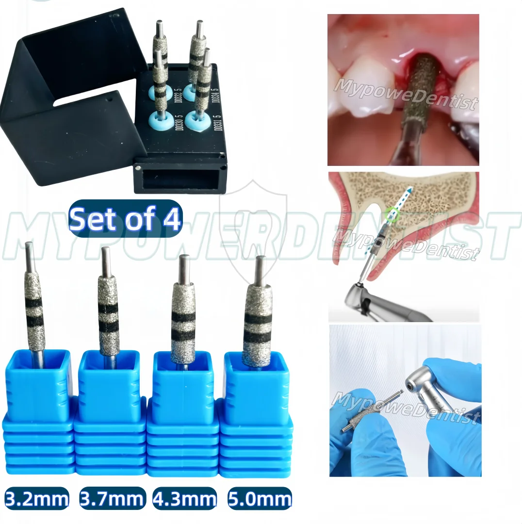 Dental Implant Guided Neck Correction Drill Diamond Grinding Jawbon FG7604 4Size