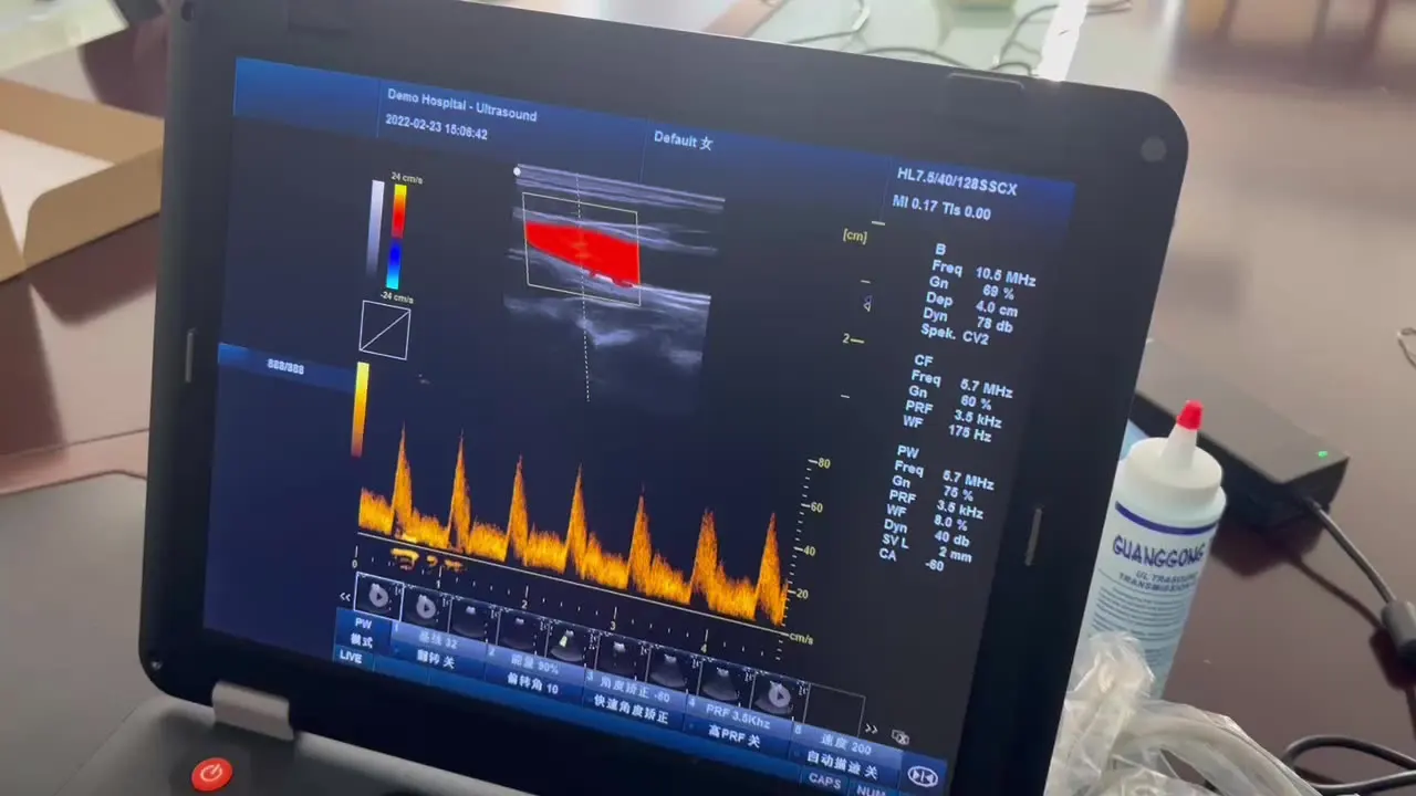 Wh-30 medical supplies 4D color doppler machine  for Hospital  siterite vascular ultrasound  price