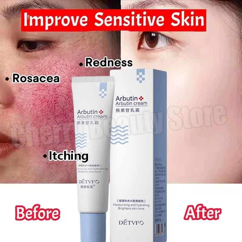 

Repair Facial Redness Cream Instant Spider Vein Remove Sensitive Skin Sooth Anti Redness Rosacea Treat Lotion Korean Cosmetics