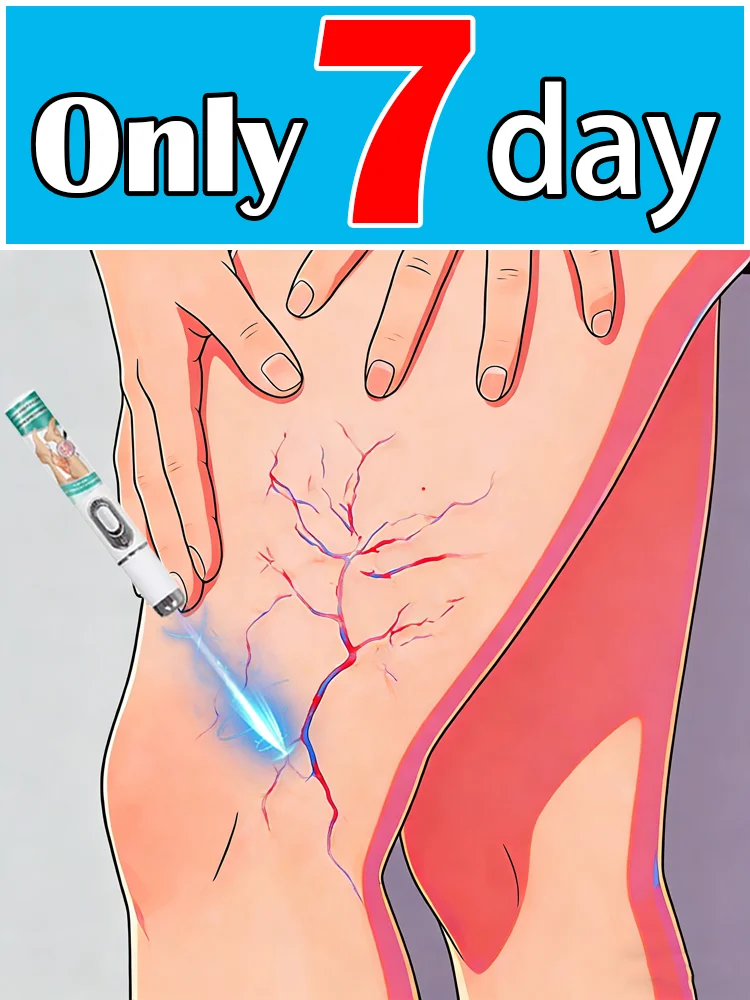 

Лазерное лечение вен нового поколения: безболезненно, безопасно и полезно для здоровья.