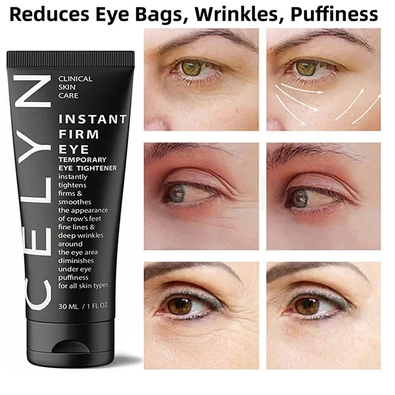 CËLYN Crema para los ojos, elimina las ojeras y tensa los ojos, Lifting, reafirmante y elimina las bolsas de los ojos, hace que tus ojos sean más