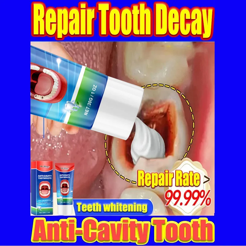 30g Anti Decay Toothpaste Dental Caries Repair Cream Prevent Decay Protect Teeth Remove Plaque Toothache Relieve Periodontitis