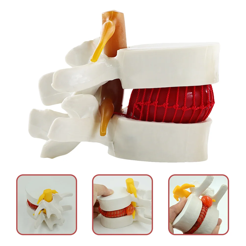 Model Intervertebral Disc Models Lumbar Vertebrae 3d Pvc Spine for Demonstrating Anatomical Herniation