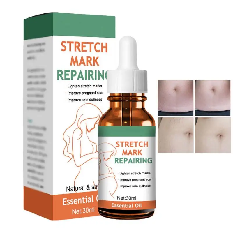 

30ml Strech Mark Removal Essence Anti-Stretch Body Cream Effective Pregnancy Stretch Mark Prevention Body Moisturizer