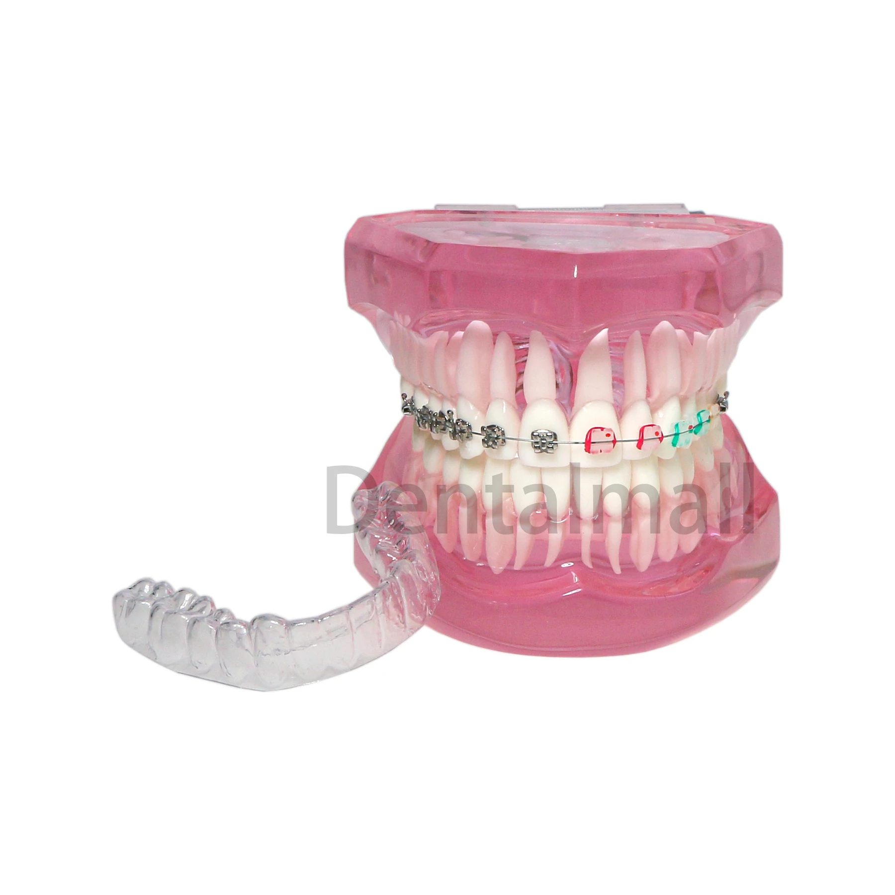 Dental Teeth Model Teaching Orthodontic with Retainer Metal Ceramic Bracket Demo M3012 Pink/Blue/Clear