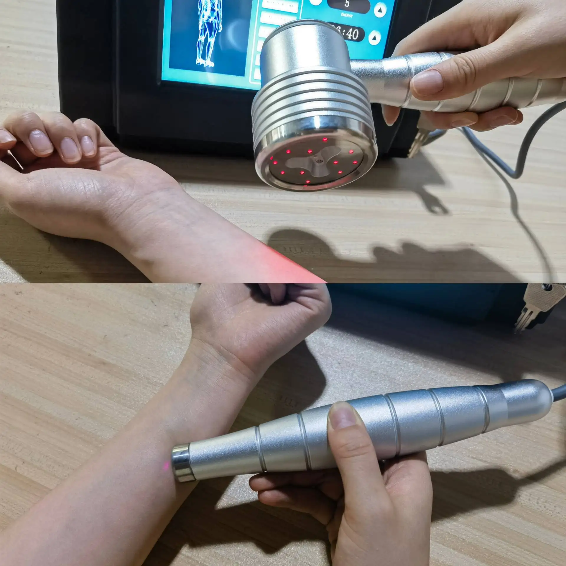 

HLKGO Устройство для лазерной терапии животных 650 нм 808 нм для больших животных, лошадей и собак, боли воспаления