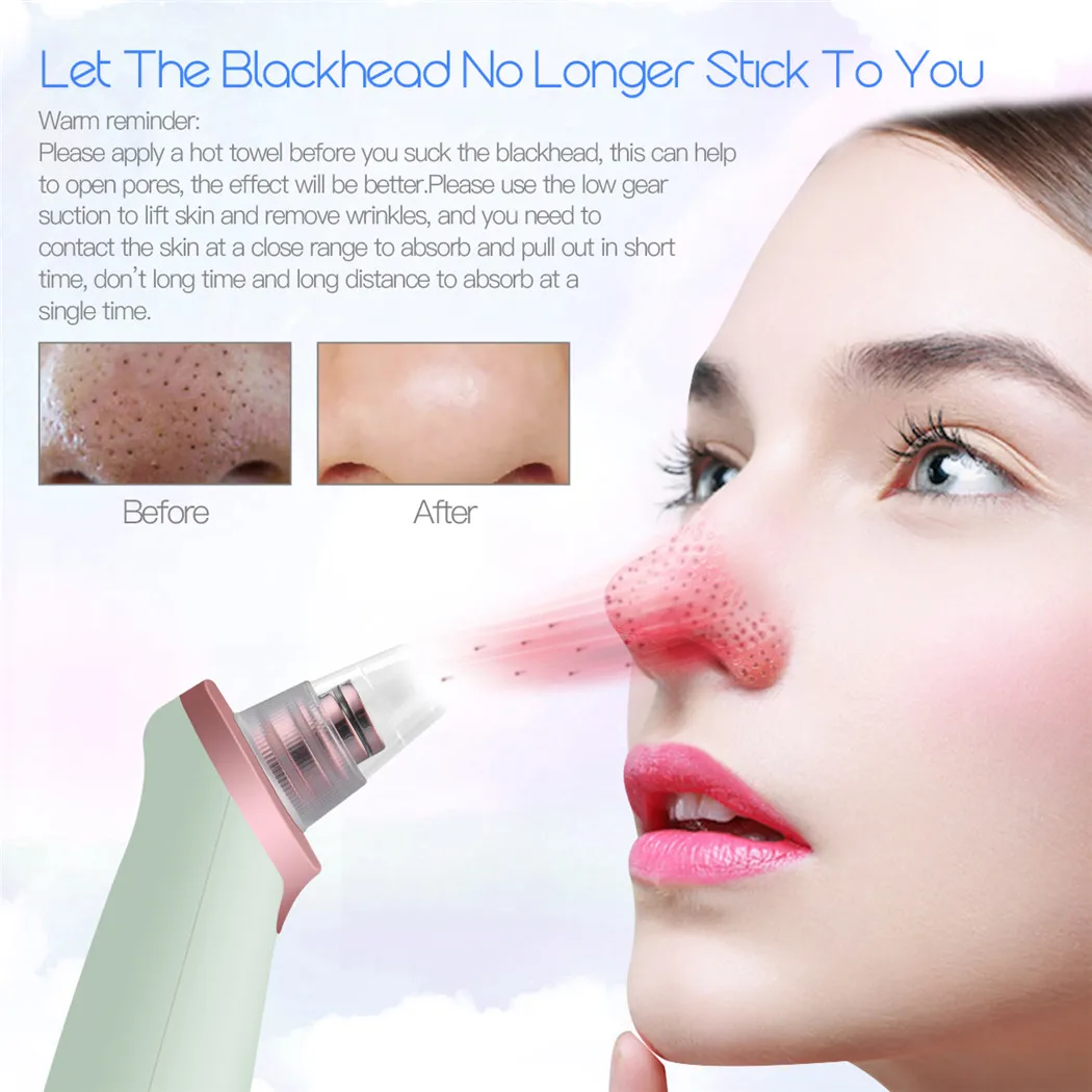 CkeyiN comedone cura della pelle viso poro profondo Acne brufolo rimozione aspirazione del vuoto diamante facciale strumento di bellezza prezzo Dropshipping