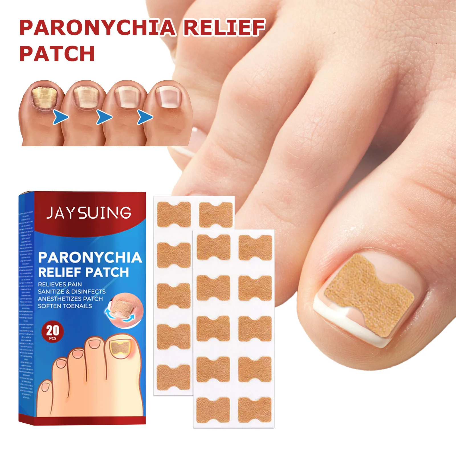 20pcs/box Nail Treatment Patch Anti Fungal Nail Correction Stickers Ingrown Toenail Care Paronychia Anti Infection Repair Patch