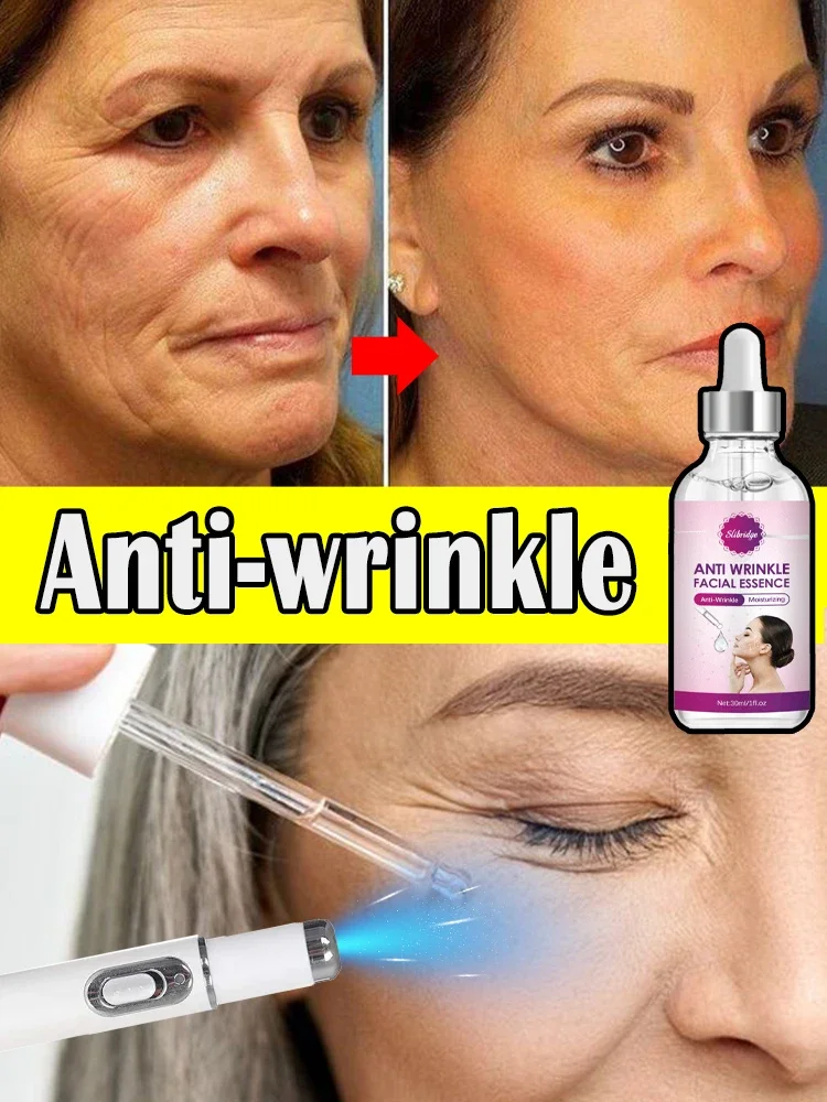 Electric Face Anti-wrinkle face and neck beauty