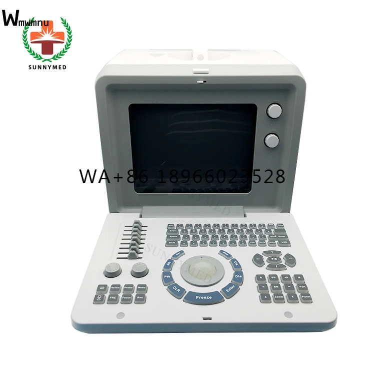 

SY-A001-1 Guangzhou Cheap Handheld Ultrasound Scanner Portable Ultrasound Machine