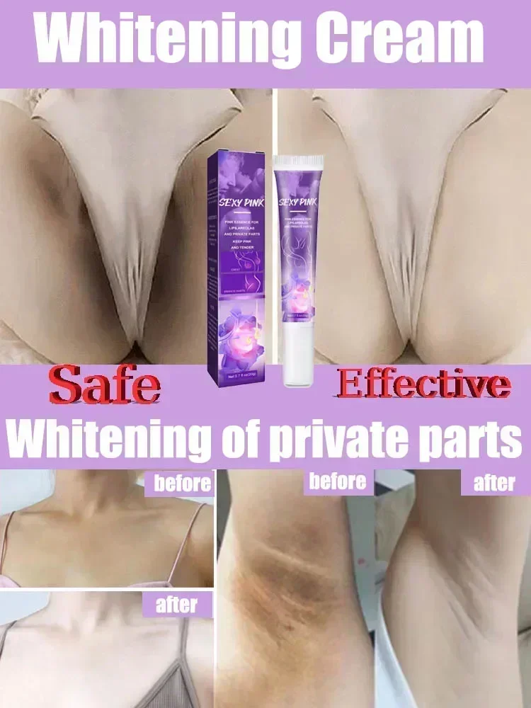 HOT SALENewSkin Whitening  for Dark Skin Lightening Private Parts Whitening   Arm Thigh Body Knees Whitening Brighten Skin Mi