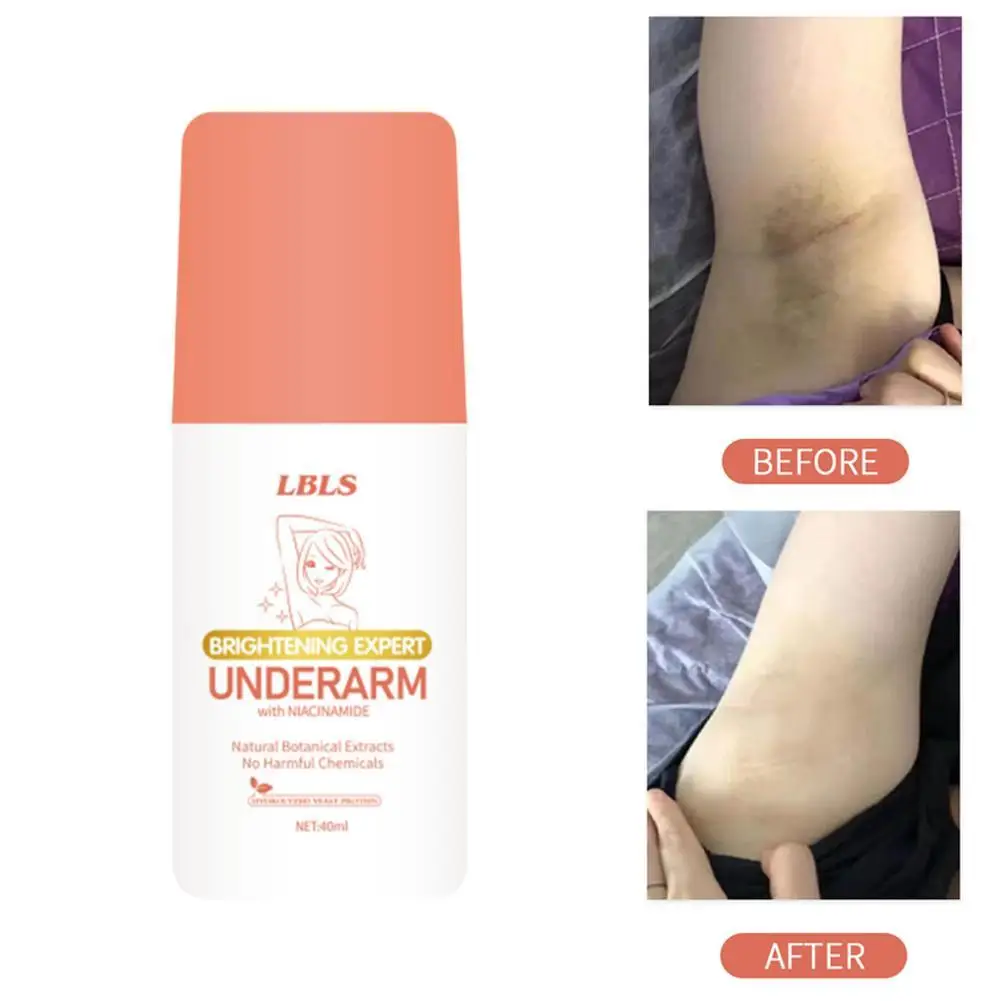 

1pcs Body Whitening Cream Private Parts Underarm Whiten Butt Knee Brighten Inner Thigh Intimate Parts Dark Remove