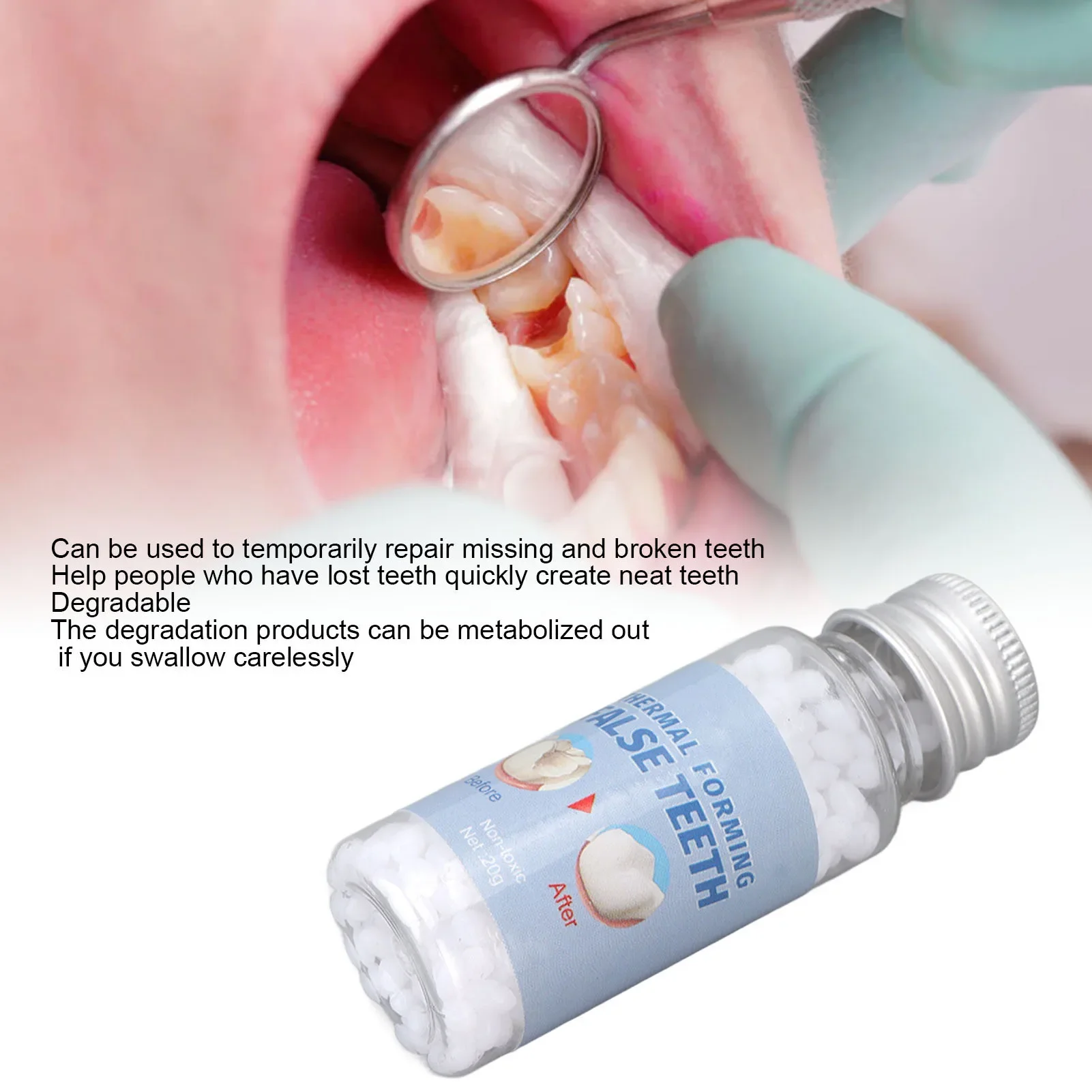 20g Temporary Teeth Filling Beads Temporary Teeth Repair Beads Dental Thermal Filling Beads for Broken Missing Tooth White