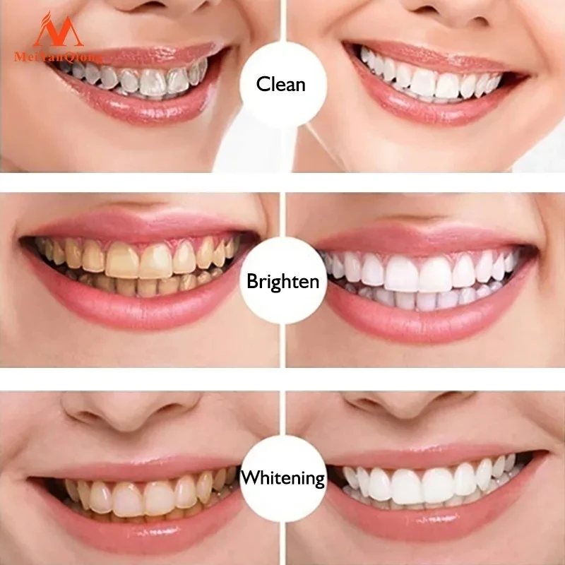 Teeth Whitening Pen Remove Plaque Tartar Clean The Mouth Tooth Brushing Essence MeiYanQiong Brush Teeth Tooth Decay Concealer