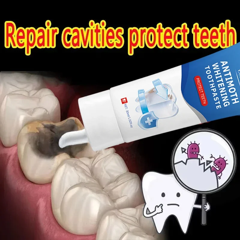 

Effective Teeth Whitening Calculus Plaque Periodontitis--Remove Cavities