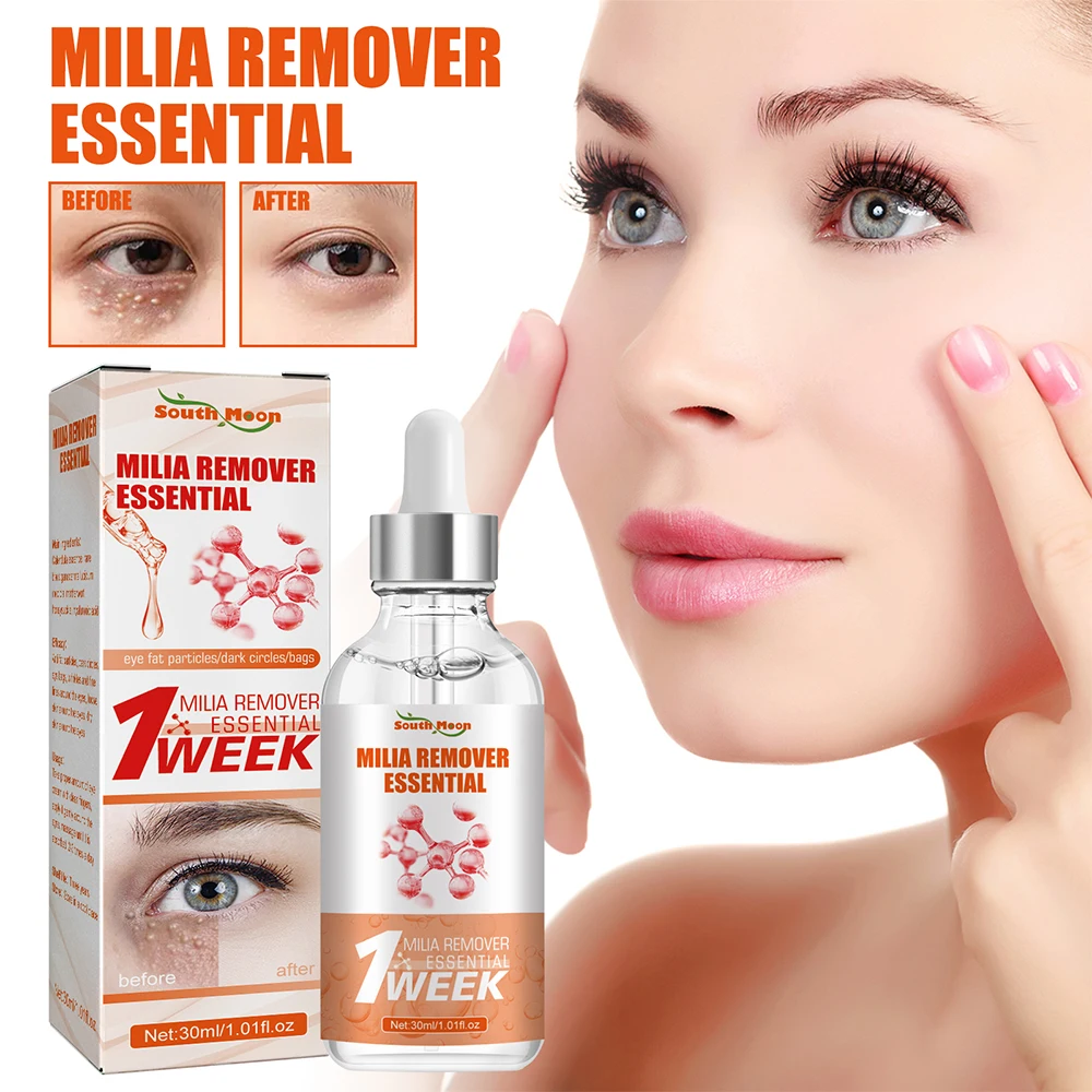 30ml Milia Remover Essential Eye Serum Effective Removes Fat Granules Eye Bags Anti-Particles Puffiness Improve Dark Cicle