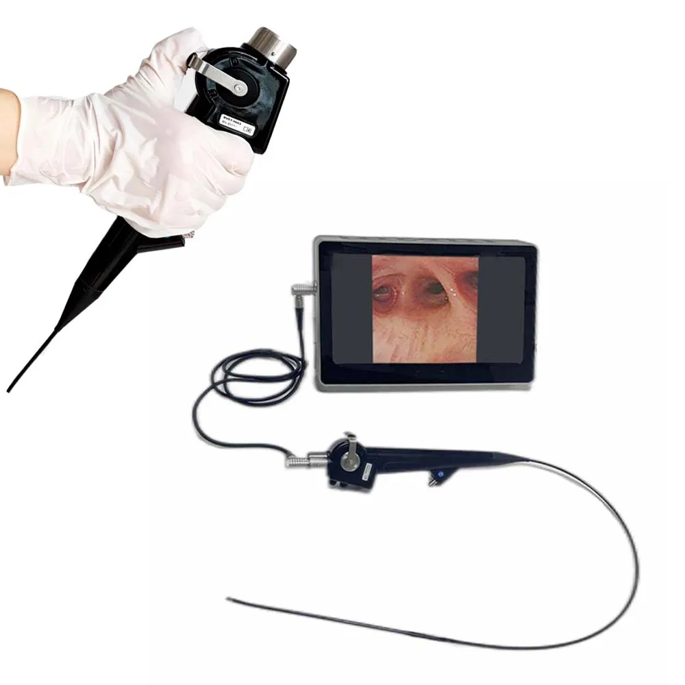 Full HD Medical Portable All In One Integrated Bronchoscopy Endoscopy Camera System