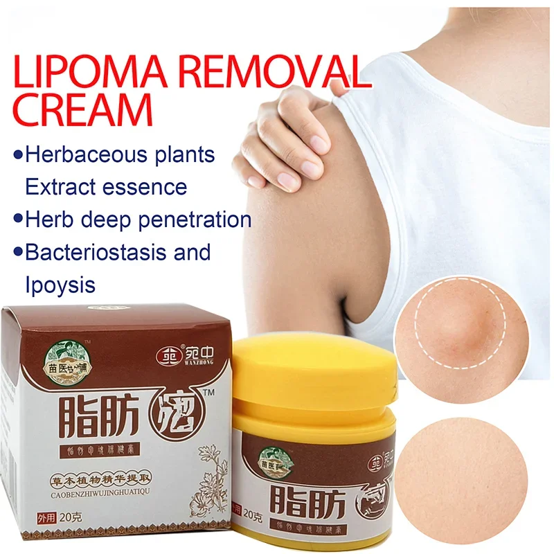 

20g Lipoma Remover Herbal Plasters Are Applied for Subcutaneous Masses Fibroids Multiple Lipomas Cellulite Treatment Creams Fat