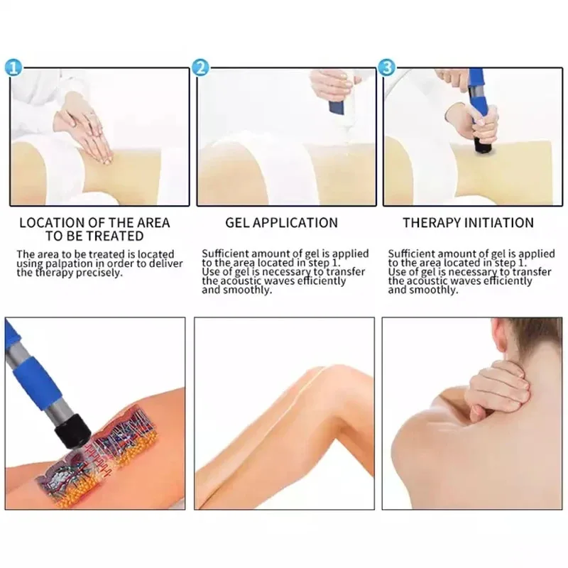 เครื่องบําบัดด้วยคลื่นกระแทกที่เน้นด้วยแม่เหล็กไฟฟ้าพร้อมการรักษา ED บรรเทาอาการปวด กายภาพบําบัดนอกร่างกาย มวลคลื่นกระแทก