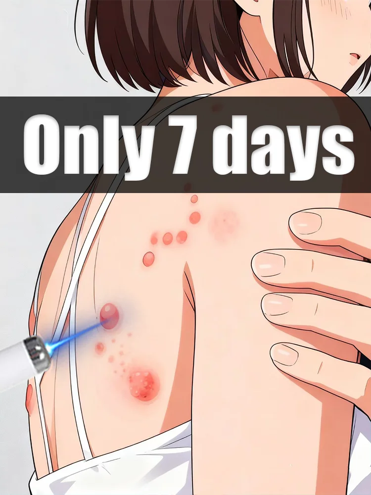 

A blue light pen that thoroughly cleanses the entire body of warts within seven days to reduce discomfort.