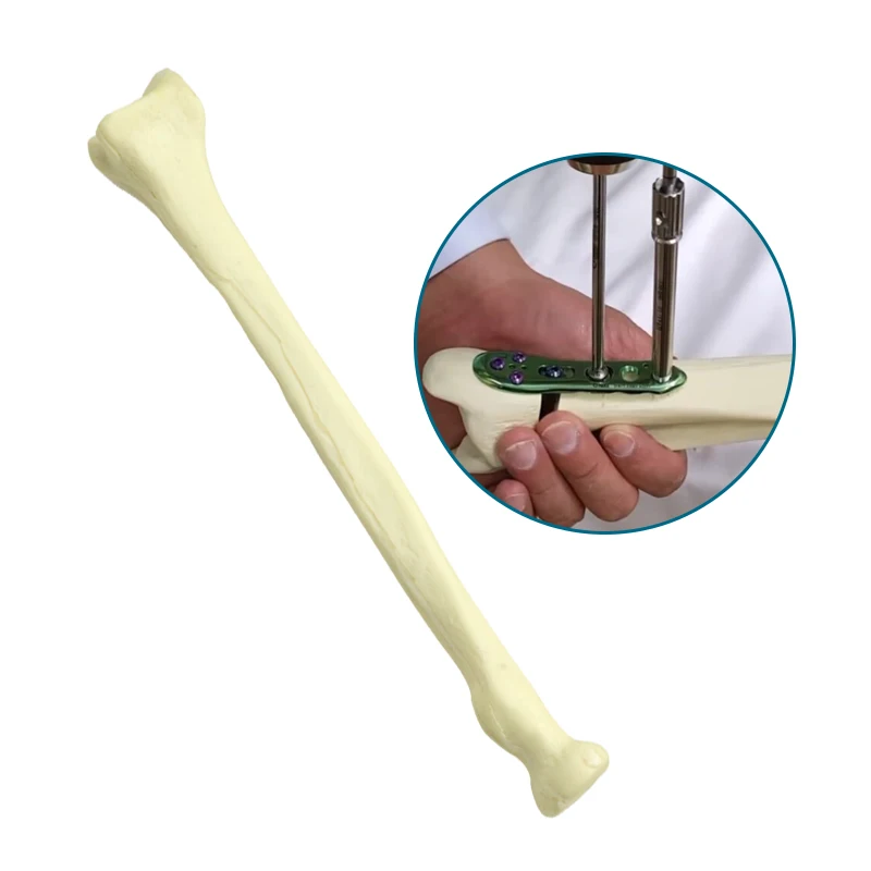 

Human Skeleton Model Radius Practice Drilling Model Medical Teaching Model