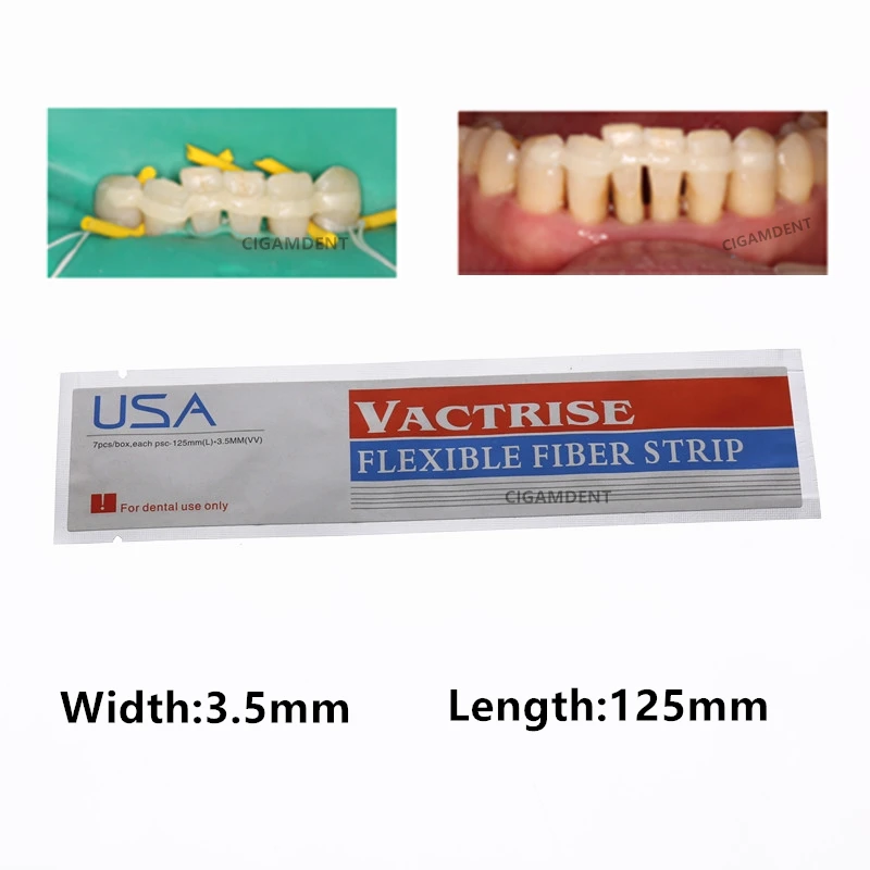 

1Pcs Dental Fiber Splint Glass Flexible Fiber Strip Composite Light -Resin Cure Bonding Strips Dentistry Material