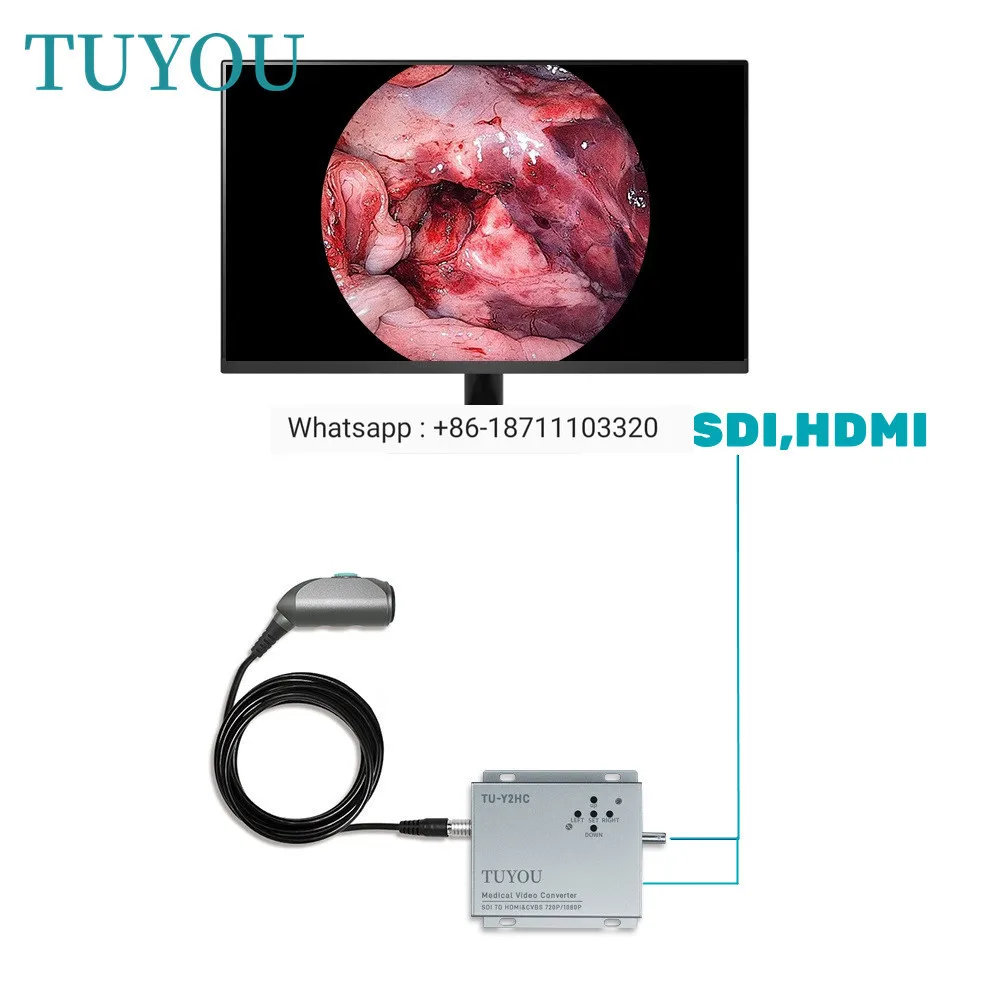 1080p HD Medical Portable Endoscopy Video Camera System with Endoscope Adapter for ENT VET