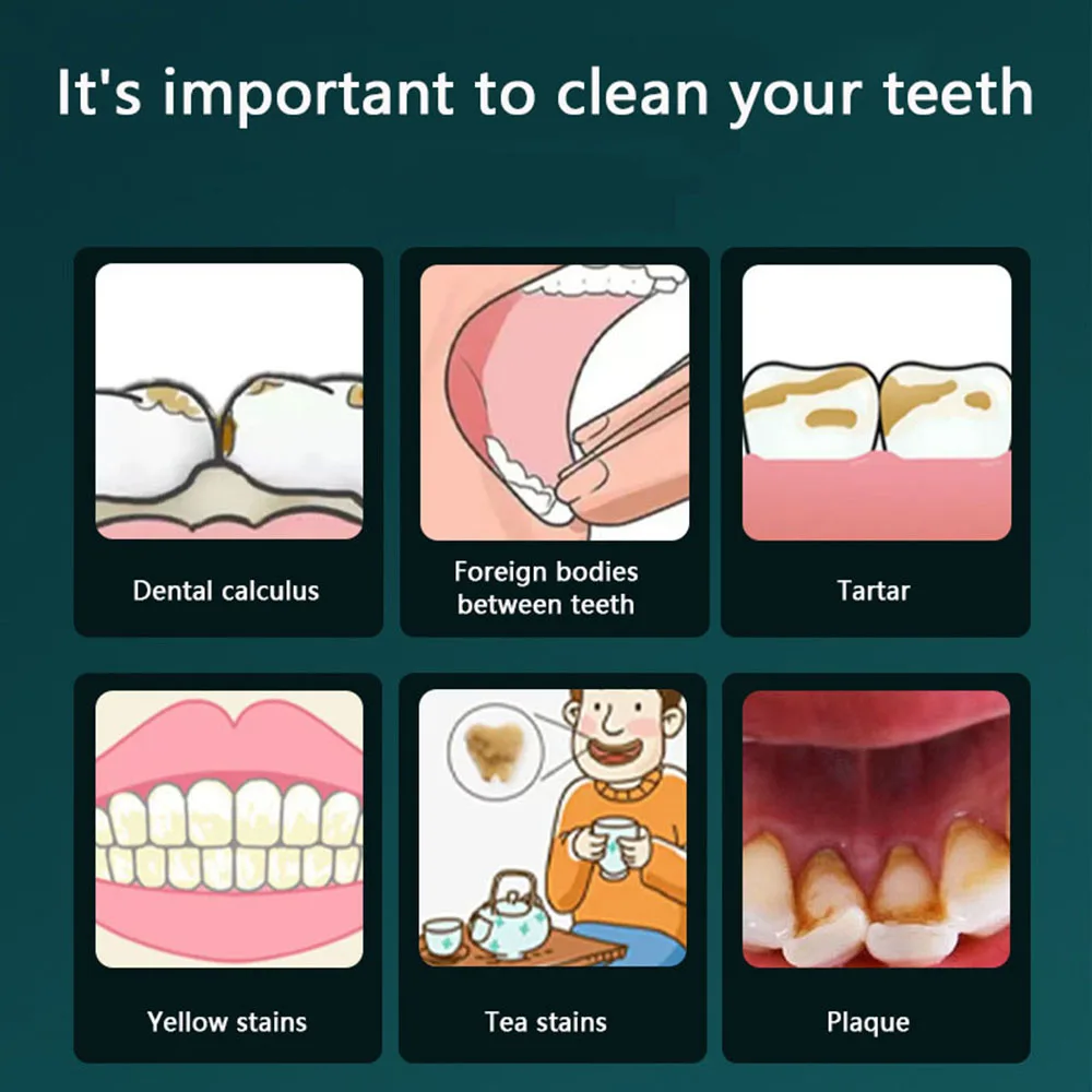 Juego de herramientas dentales de acero inoxidable, endoscopio para cuidado Dental, limpieza de cálculo, eliminación de manchas y sarro