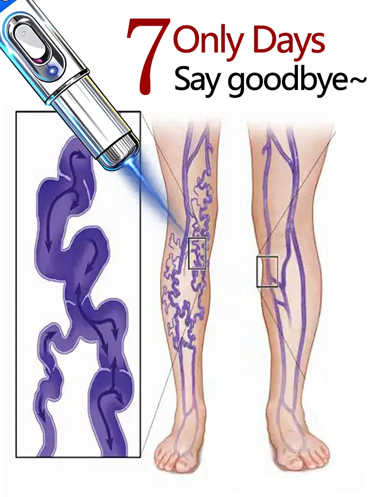 

2025UPGRADE for legs, Body tools,Solve your trouble,Unisex