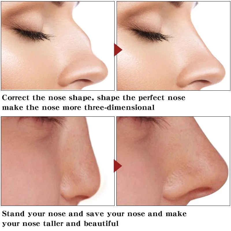 Nose Up Heighten Rhinoplasty Oil Nose Up Whitening Cream Nasal Bone Remodeling Pure Natural Care Thin Smaller Nose