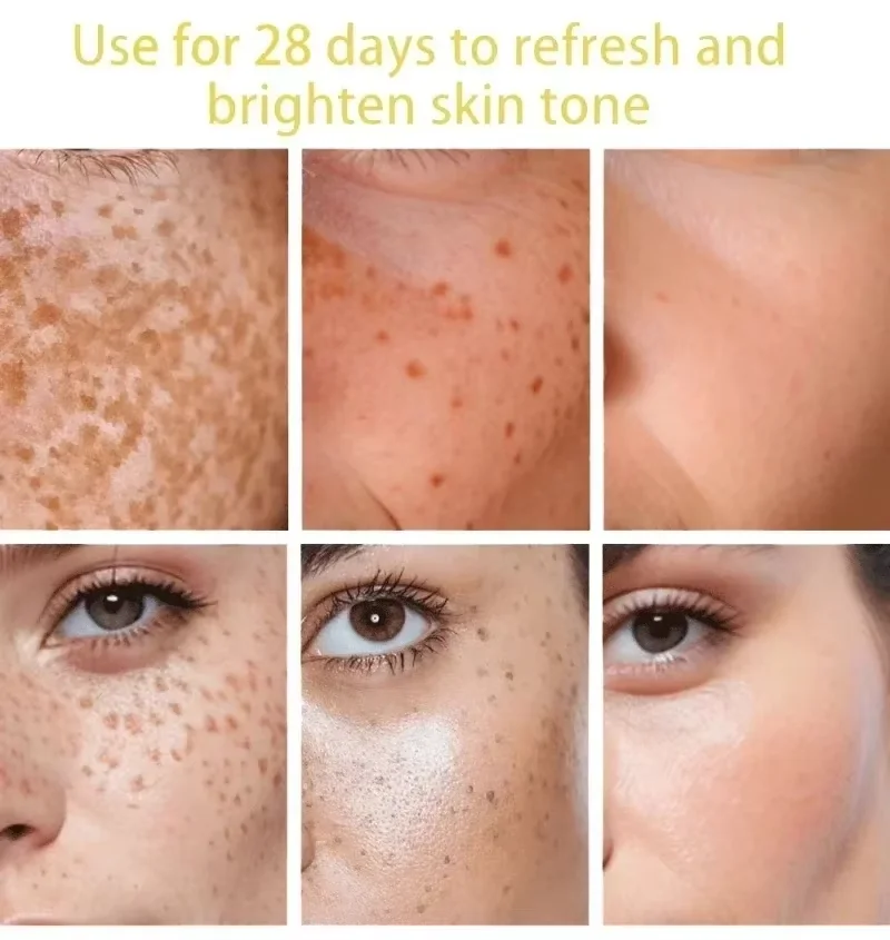 Powerful Dark Spots Remover Freckle Whitening Serum Melanin Correcting Anti Pigmentation Brighten Korean Day Night Facial Care