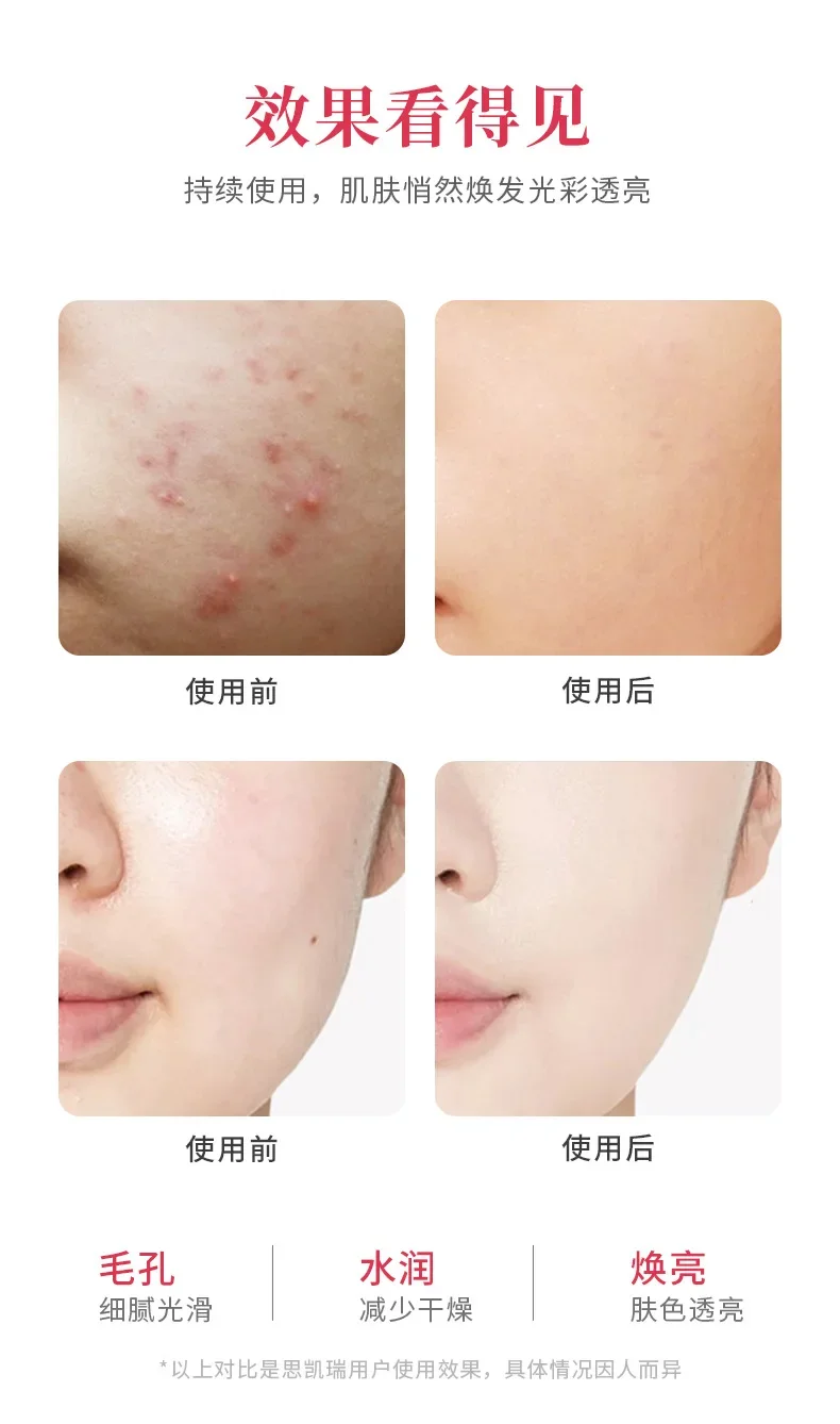 Bluetooth Bubble Cleanser Reiniging Multi-Level Puls Geluidsgolf Intelligente Verjongingsmassage