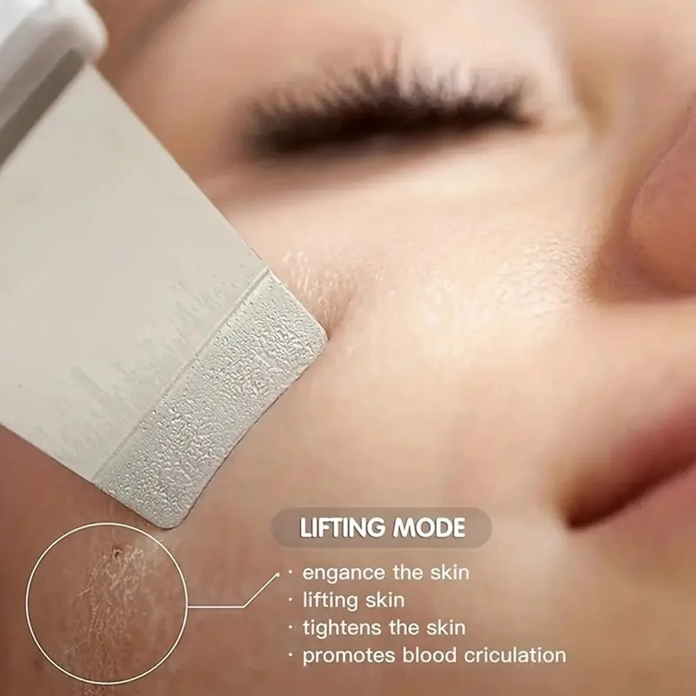 Ultrasone Huid Scrubber Peeling Comedondrukker Diepe Gezichtsreiniging Ultrasone Ion Acne Pore Cleaner Facial Schop Scrubber
