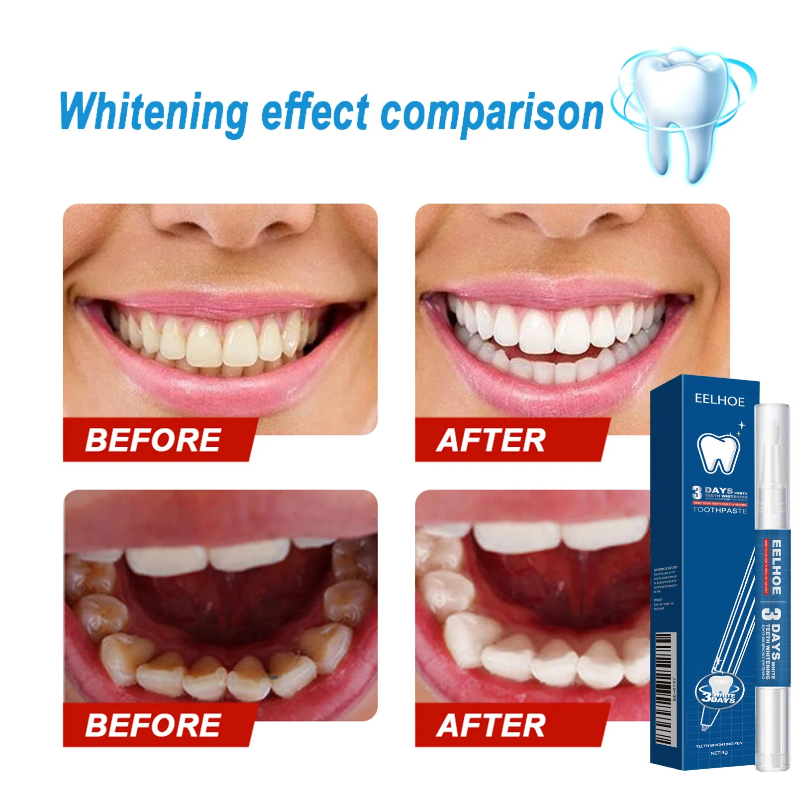 3ml Teeth Whitening Pen Teeth Gel Whitener Bleach Remove Stains Oral Hygiene Instant Smile Teeth Whitening Kit Cleansing Serum