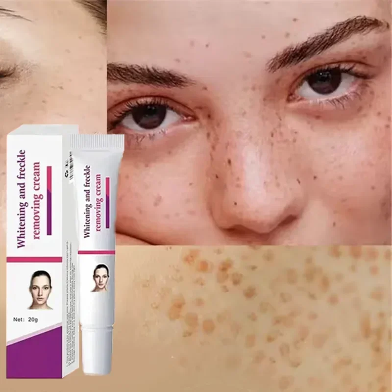 Crema eficaz para eliminar pecas para el cutis radiante